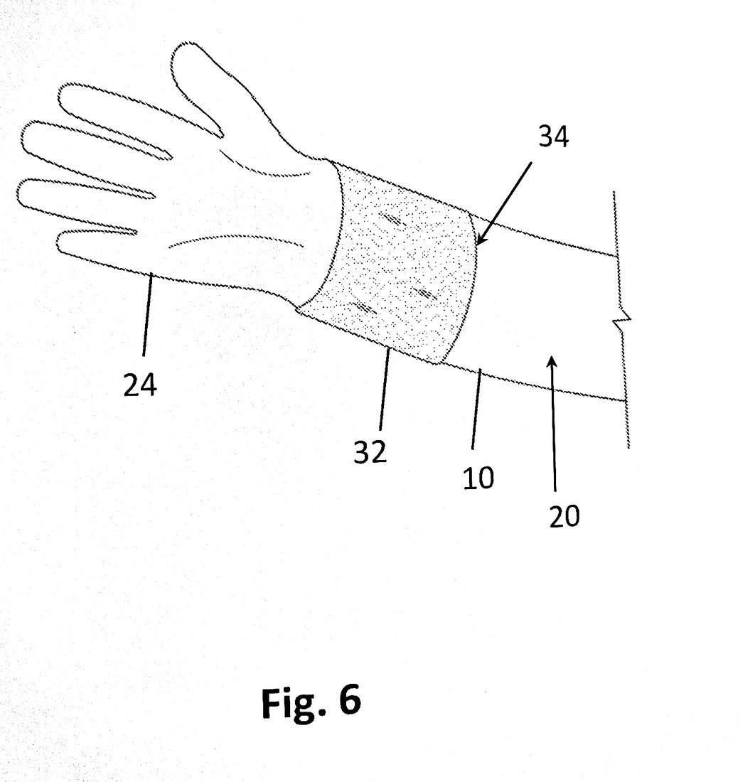 Patent Fig. 6: the glove in donning position